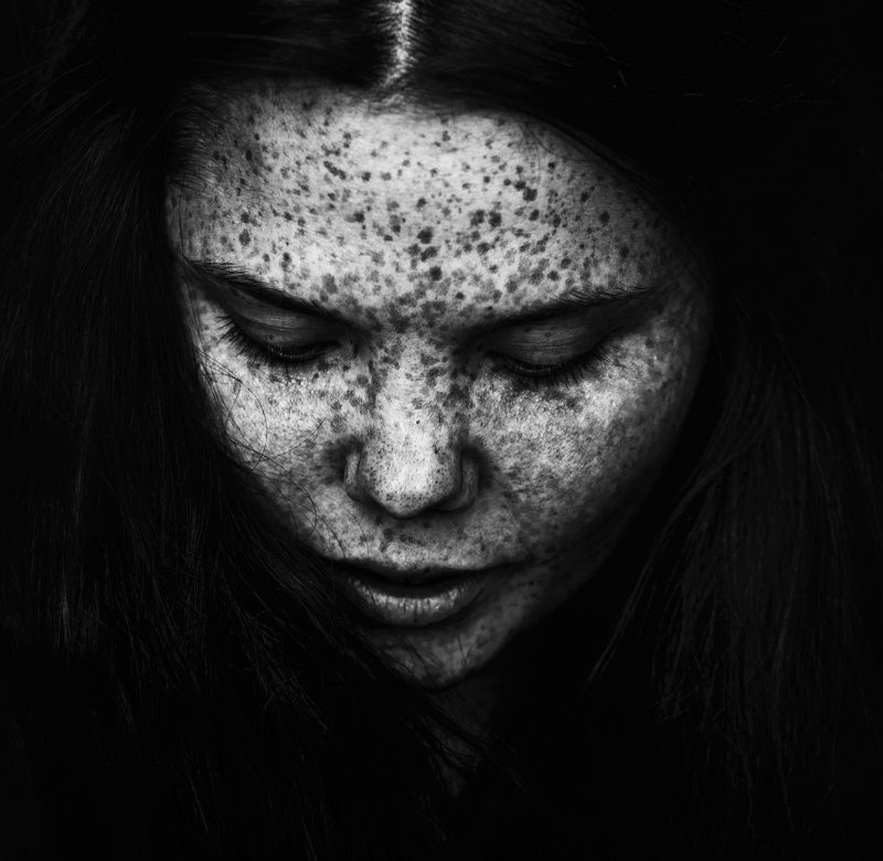 Plakat med Amanda - We Are Freckled